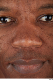 Photos of Juvante Henderson nose 0001.jpg